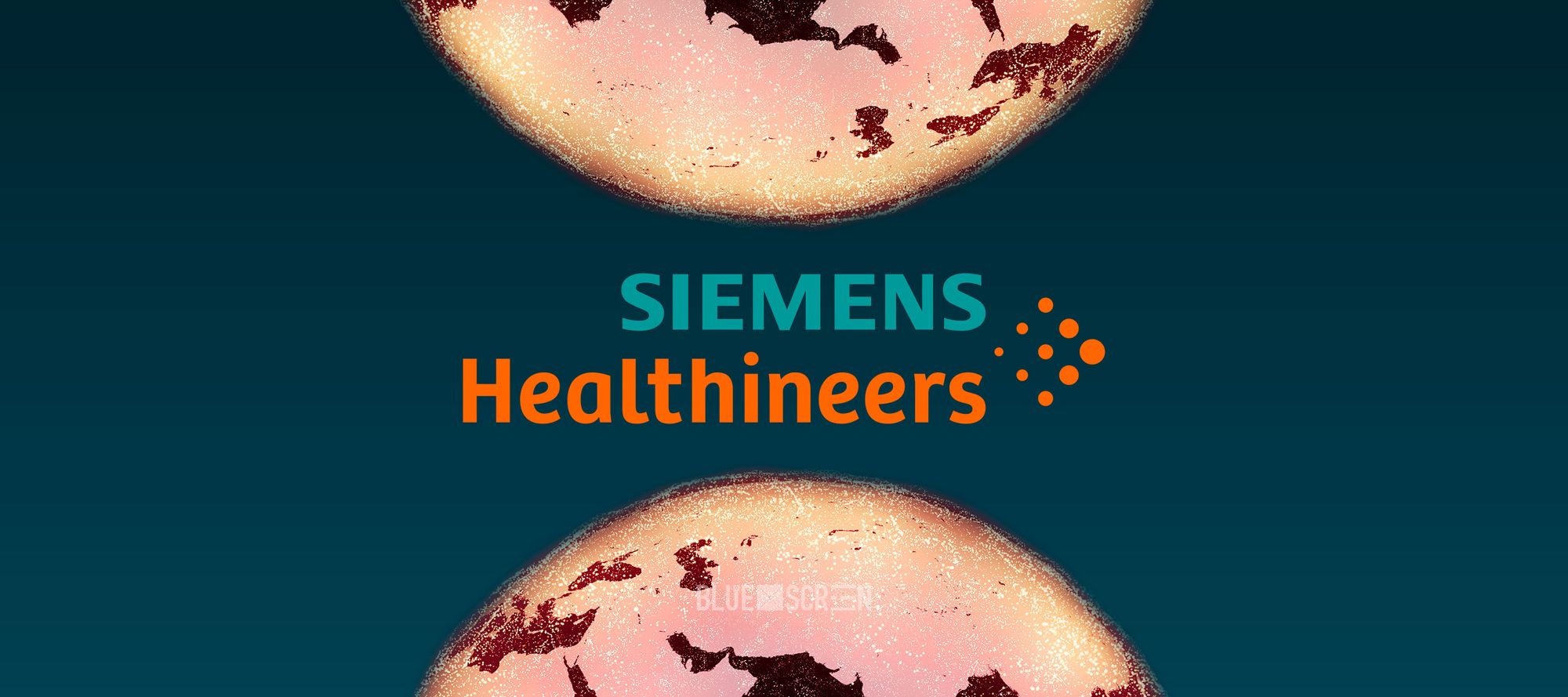 Казахстанский стартап Cerebra будет консультировать Siemens Healthineers